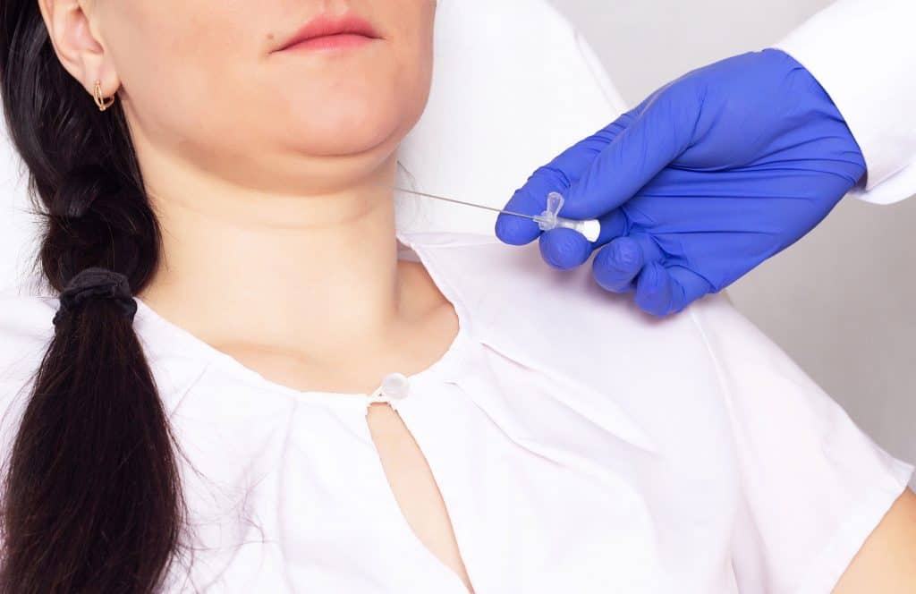 Medical Procedures To Get Rid Of Double Chin