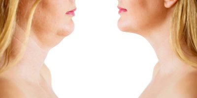 How to Get Rid of Double Chin & Chin Fat